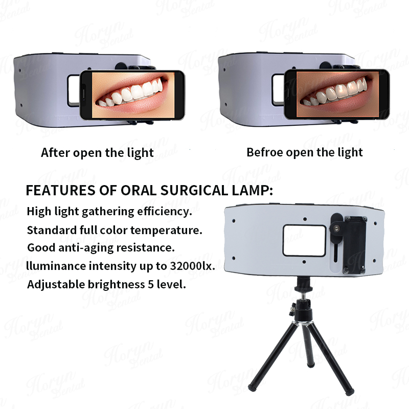 Dental Flash Light Photography - Photography Lighting Led 评论和价格